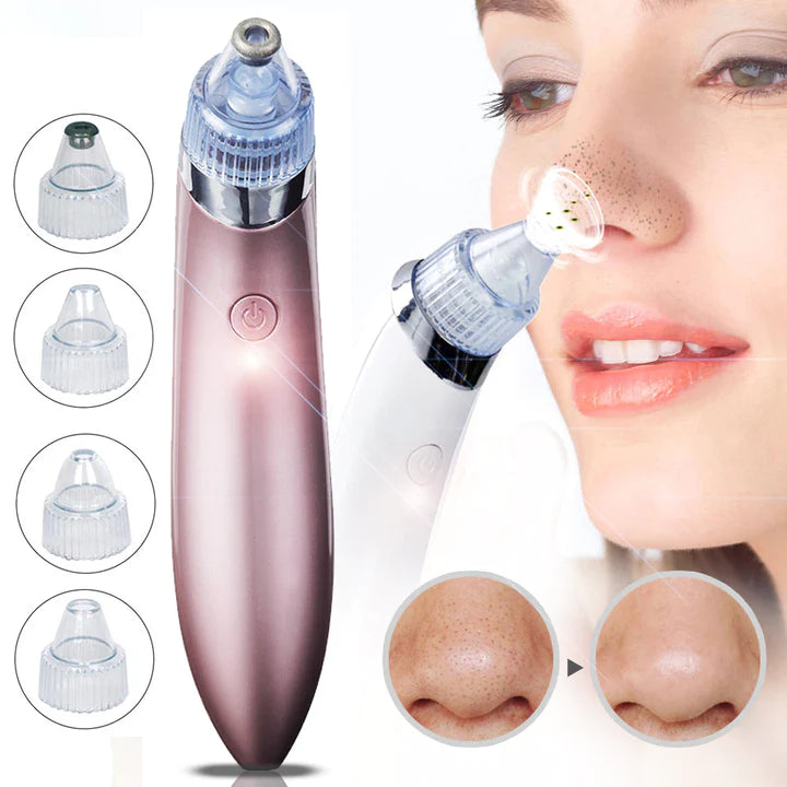 Aspirator Vacuum Facial Cleanser pentru Curatarea Tenului, aspirare si curatire cosuri, puncte negre, pori, acnee